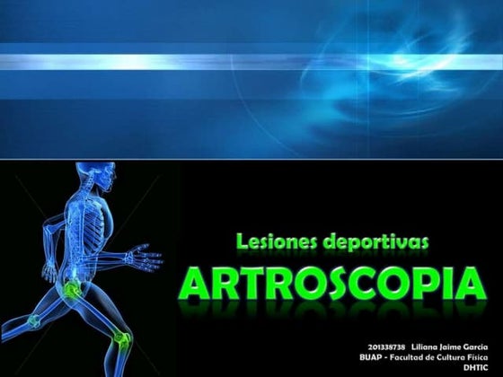 ¿Cuándo se inventó la artroscopia?